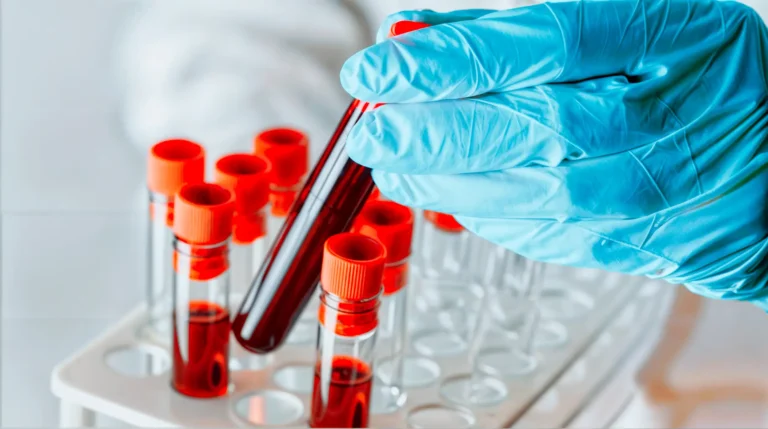 Toma de muestras de laboratorio clínico